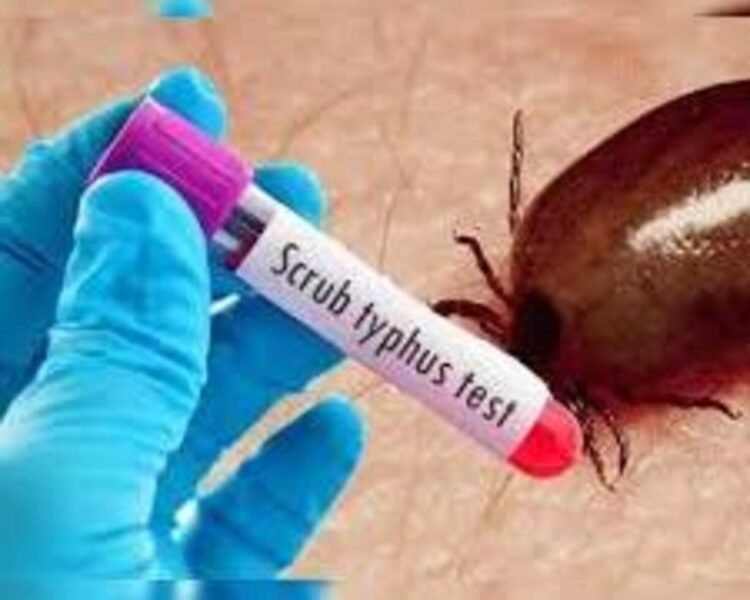 Scrub Typhus Trends Highlight Importance of Surveillance and Early Care